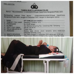 Wanita Asal Camplong Mengaku Dikeroyok Tiga Wanita