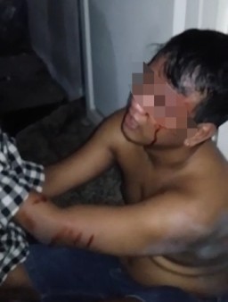 Maling Apes, Dihajar Warga Hingga Bonyok Sebelum Polisi Datang