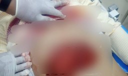 Kakak Bunuh Adik di Jrengik Sampang