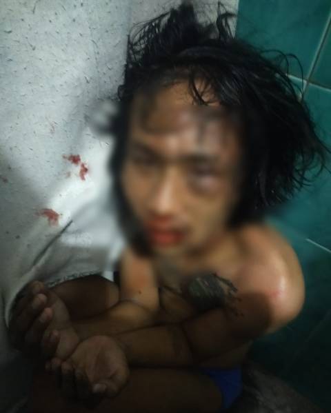 Pelaku bonyok dihajar warga