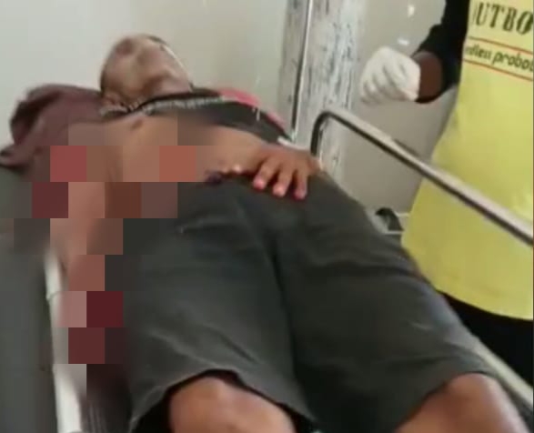 Korban pembacokan di Sampang 