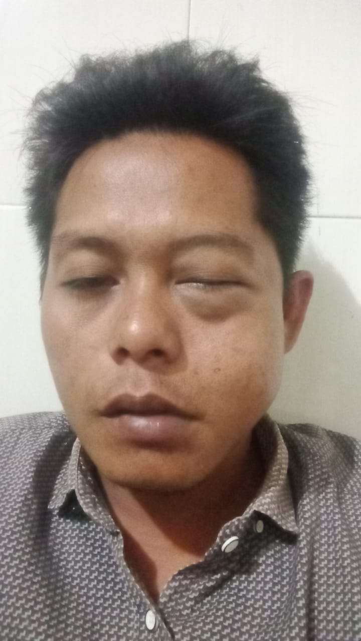 Warga jadi Korban pemukulan di Sumenep